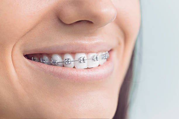 Best Full Mouth Reconstruction  in Meyers, CA